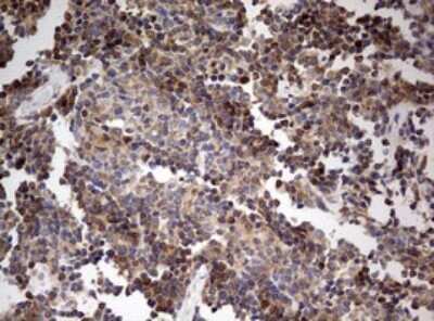 Immunohistochemistry: OAS2 Antibody (OTI6E6) [NBP2-46293]
