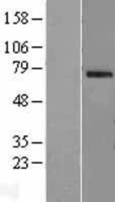 Western Blot: OAS2 Overexpression Lysate [NBL1-13897]