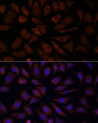 Immunocytochemistry/ Immunofluorescence: OAS3 Antibody - Azide and BSA Free [NBP2-94081]