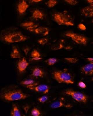 Immunocytochemistry/ Immunofluorescence: OAS3 Antibody - Azide and BSA Free [NBP2-94081]