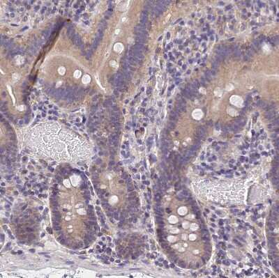 Immunohistochemistry-Paraffin: OAS3 Antibody [NBP1-85841]