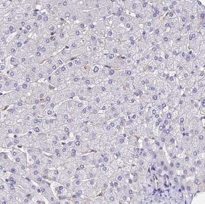 Immunohistochemistry-Paraffin: OAS3 Antibody [NBP1-85841]