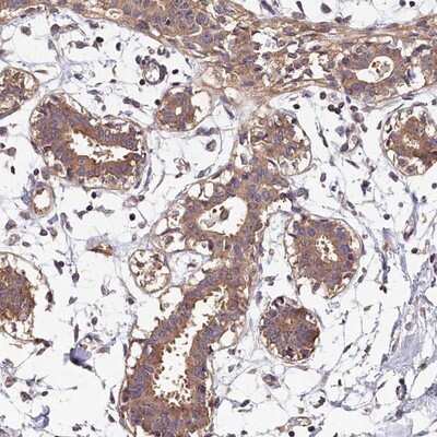 Immunohistochemistry-Paraffin: OAS3 Antibody [NBP1-85845]