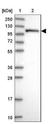 Western Blot: OAS3 Antibody [NBP1-85841]