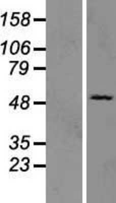 Western Blot: OAS3 Overexpression Lysate [NBP2-07655]