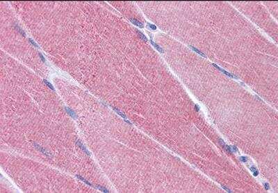 Immunohistochemistry-Paraffin: OASIS/CREB3L1 Antibody [NB600-799]