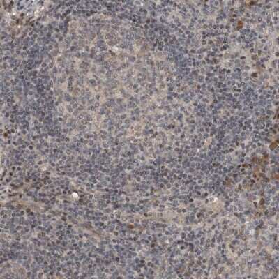 Immunohistochemistry-Paraffin: OASIS/CREB3L1 Antibody [NBP1-82503]