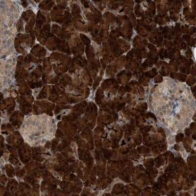 Immunohistochemistry-Paraffin: OASIS/CREB3L1 Antibody [NBP1-82503]
