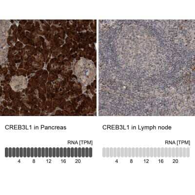 Immunohistochemistry-Paraffin: OASIS/CREB3L1 Antibody [NBP1-82503]