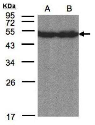 Western Blot: OASIS/CREB3L1 Antibody [NBP1-31017]