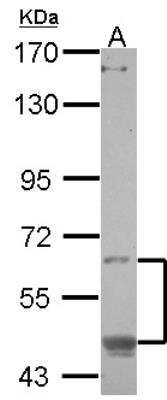 Western Blot: OASIS/CREB3L1 Antibody [NBP2-16007]