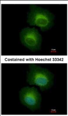 Immunocytochemistry/ Immunofluorescence: OASL Antibody [NBP2-19618]