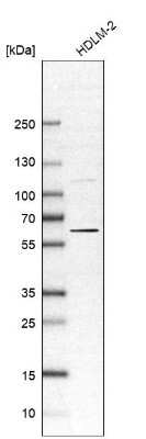 Western Blot: OASL Antibody [NBP1-87363]