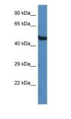 Western Blot: OASL Antibody [NBP1-91626]