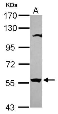 Western Blot: OASL Antibody [NBP2-19619]