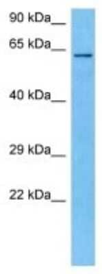 Western Blot: OASL2 Antibody [NBP3-10127]