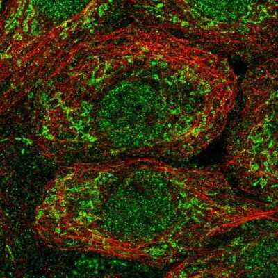 Immunocytochemistry/ Immunofluorescence: OAT Antibody [NBP2-56409]