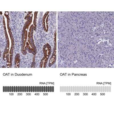 Immunohistochemistry-Paraffin: OAT Antibody [NBP1-83239]