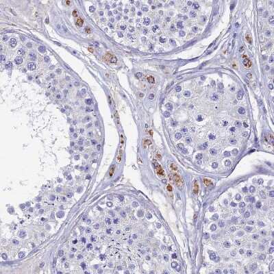 Immunohistochemistry-Paraffin: OAT Antibody [NBP1-83239]