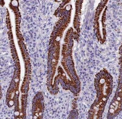 Immunohistochemistry-Paraffin: OAT Antibody [NBP1-83239]