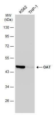 Western Blot: OAT Antibody [NBP1-32390]