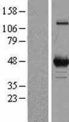 Western Blot: OAT Overexpression Lysate [NBP2-04155]