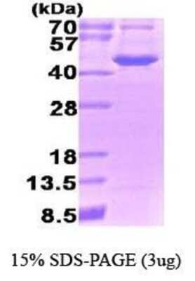 SDS-PAGE: Recombinant Human OAT Protein [NBP1-37077]