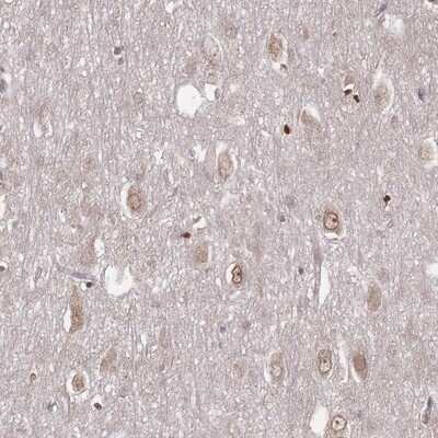 Immunohistochemistry-Paraffin: OATL1 Antibody [NBP2-13412]