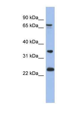 Western Blot: OATL1 Antibody [NBP1-56840]