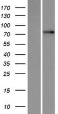 Western Blot: OATL1 Overexpression Lysate [NBP2-10837]