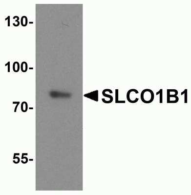 Western Blot: OATP1B1/OATP2 AntibodyBSA Free [NBP2-81750]