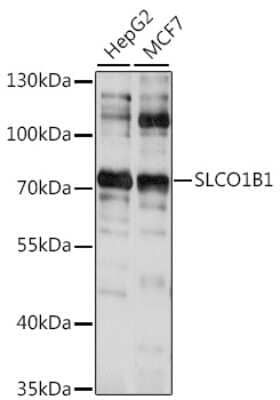 Western Blot: OATP1B1/OATP2 AntibodyAzide and BSA Free [NBP2-93560]