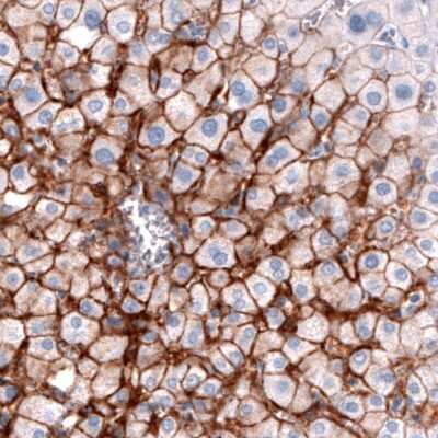 Immunohistochemistry-Paraffin: OATP1B3/SLCO1B3/OATP8 Antibody (CL3770) [NBP2-61636]