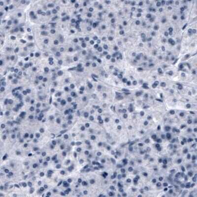 Immunohistochemistry-Paraffin: OATP1B3/SLCO1B3/OATP8 Antibody (CL3770) [NBP2-61636]