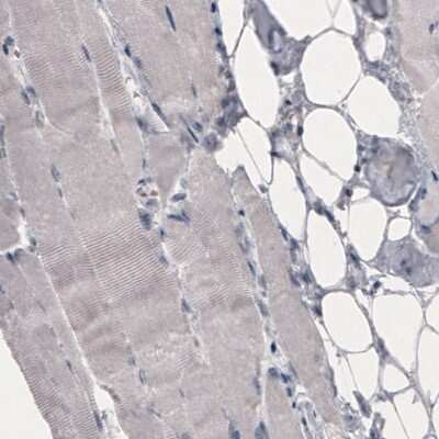 Immunohistochemistry-Paraffin: OATP1B3/SLCO1B3/OATP8 Antibody (CL3771) [NBP2-61637]