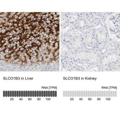 Immunohistochemistry-Paraffin: OATP1B3/SLCO1B3/OATP8 Antibody [NBP1-80980]