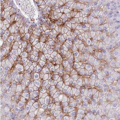 Immunohistochemistry-Paraffin: OATP1B3/SLCO1B3/OATP8 Antibody [NBP2-54739]