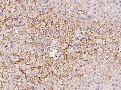 Immunohistochemistry-Paraffin: OATP1B3/SLCO1B3/OATP8 Antibody [NBP2-98474]