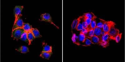 Immunocytochemistry/ Immunofluorescence: OATP2/8 Antibody (MDQ) [NB100-74482]