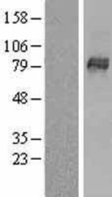 Western Blot: OATP1B3/SLCO1B3/OATP8 Overexpression Lysate [NBL1-16204]