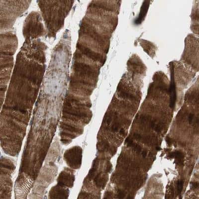 Immunohistochemistry-Paraffin: OAZ1 Antibody [NBP1-88925]