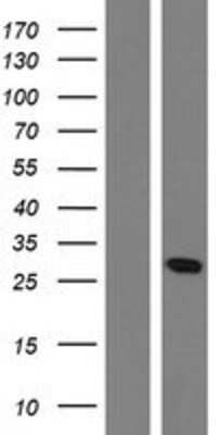 Western Blot: OAZ1 Overexpression Lysate [NBP2-07904]