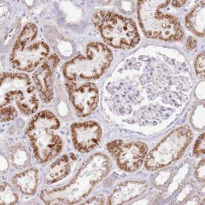 Immunohistochemistry-Paraffin: OAZ2 Antibody [NBP2-32056]