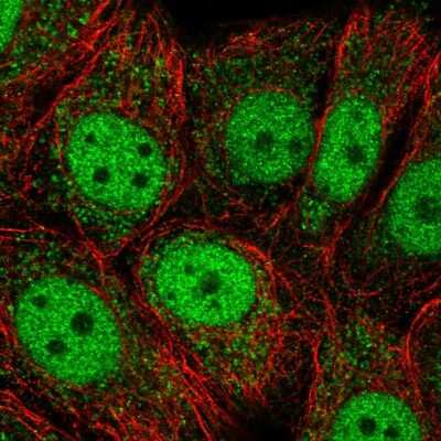 Immunocytochemistry/ Immunofluorescence: OAZ3 Antibody [NBP2-56186]