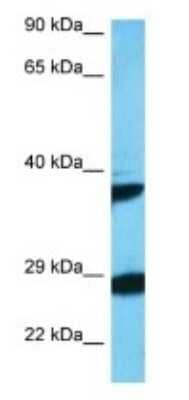 Western Blot: OBCAM/OPCML Antibody [NBP3-09427]