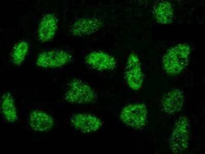 Immunocytochemistry/ Immunofluorescence: OBFC1 Antibody [NBP2-99011]