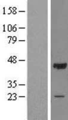 Western Blot: OBFC1 Overexpression Lysate [NBL1-13899]