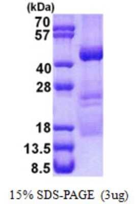 SDS-PAGE: Recombinant Human OBFC1 His Protein [NBP2-23308]