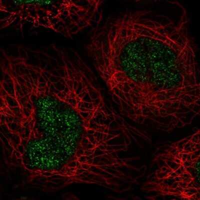 Immunocytochemistry/ Immunofluorescence: OBFC2A Antibody [NBP2-58805]