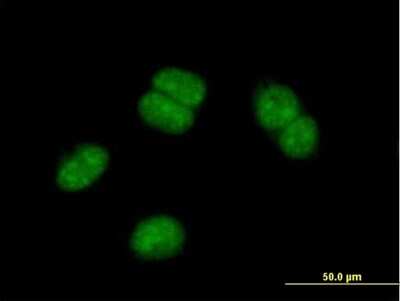 Immunocytochemistry/ Immunofluorescence: OBFC2B Antibody [H00079035-B01P]